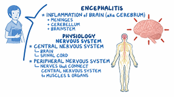 Encephalitis