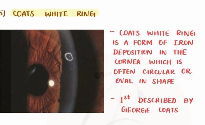 Coats White Ring