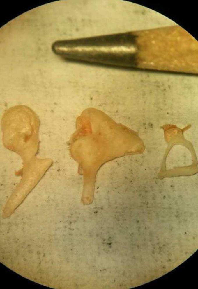 Ear ossicles