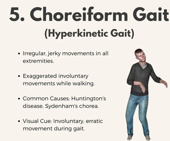 Choreiform Gait