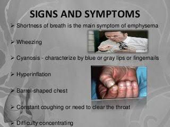 Emphysema symptoms