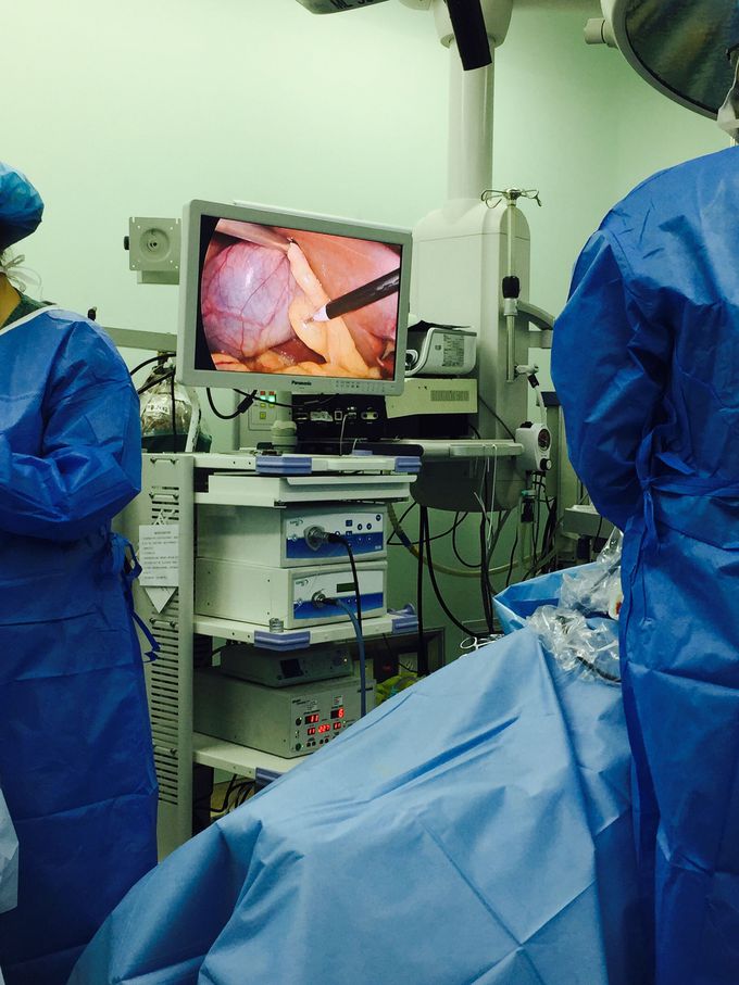 #cholecystectomy