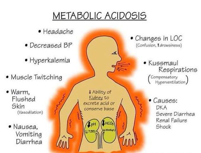 Metabolic acidosis