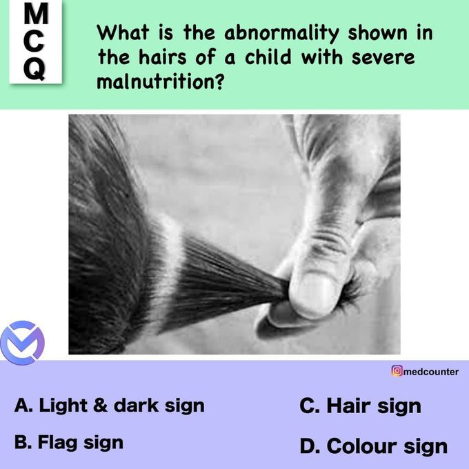 Identify the abnormality due to malnutrition
