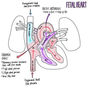 Fetal Heart - MEDizzy