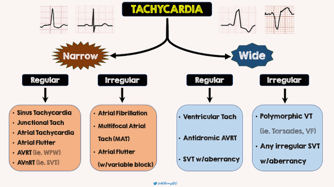 Tachycardia Classification