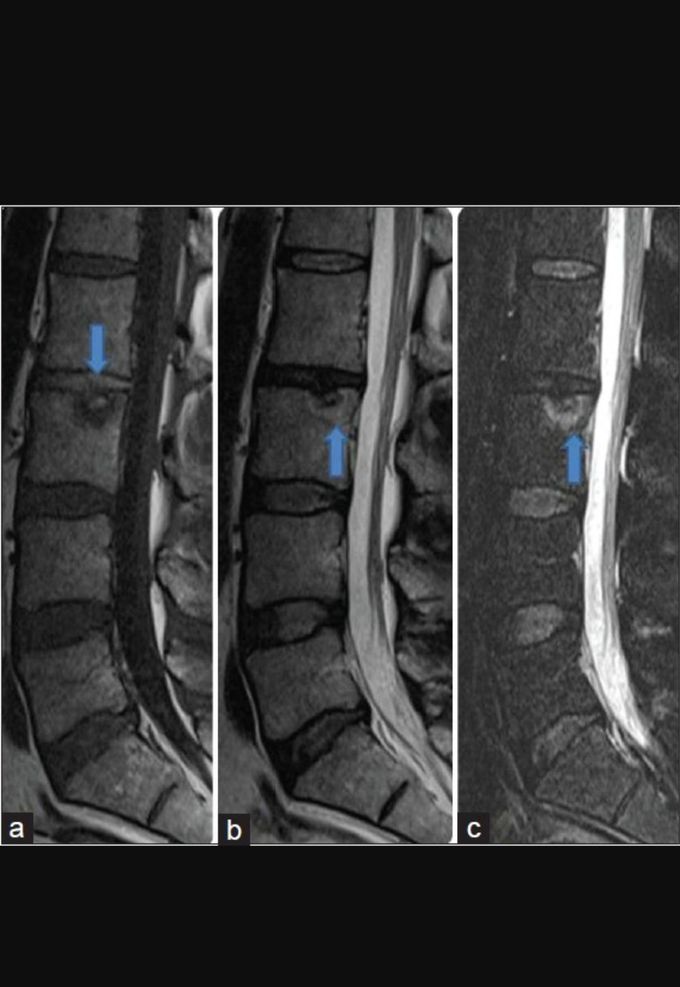Diagnosis?