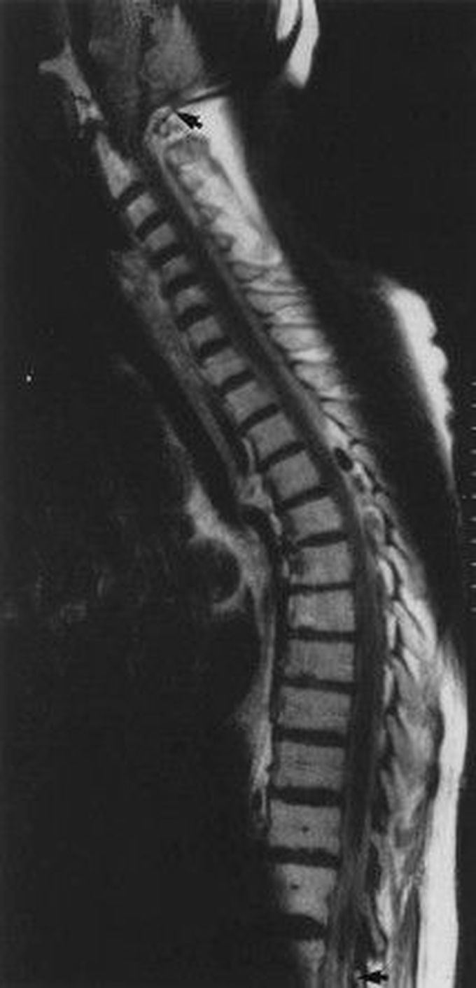 Non-spinal Causes of Backache