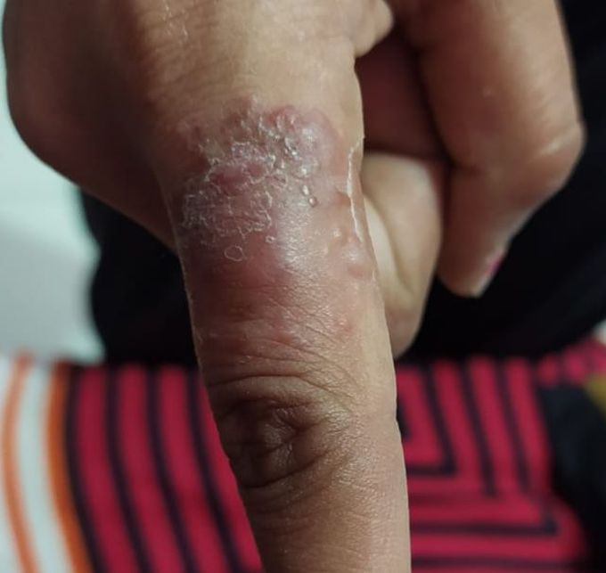 What's your diagnosis?
