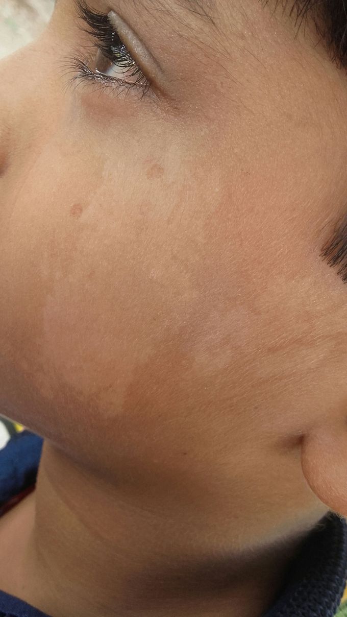 Pls diagnose..