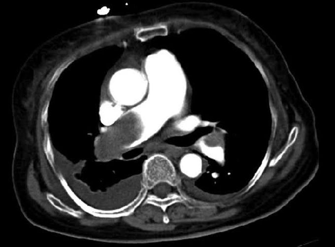 Diagnosis??