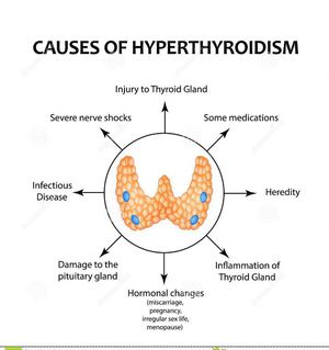 Causes of hyperthyroidism - MEDizzy