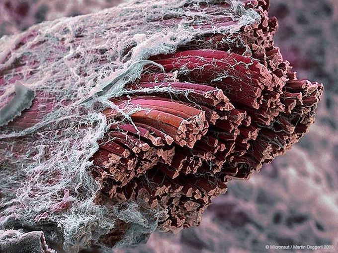 Skeletal muscles