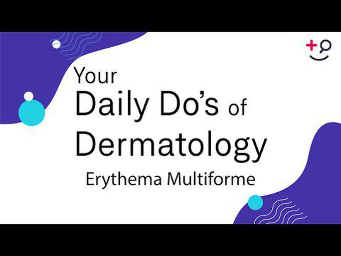 Dermatology related to Erythema Multiforme