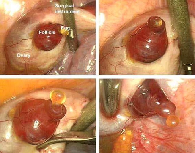 Ovulation