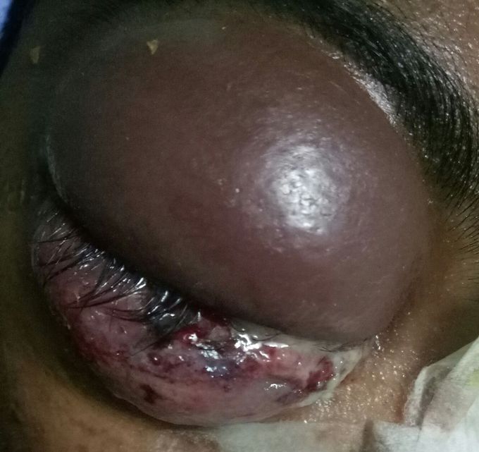 Plz tell me treatment & disease name