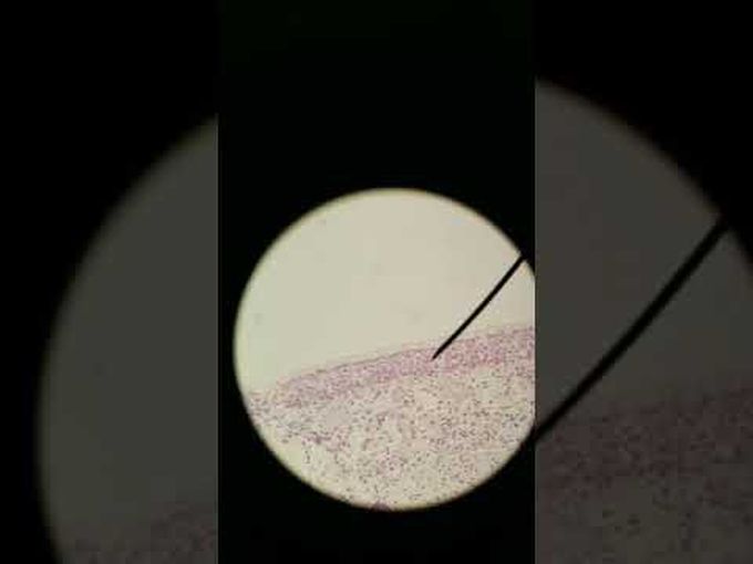 Histology- Nasal epithelium