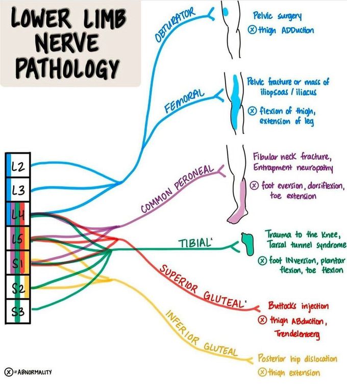 Lower Limb Nerve Pathology