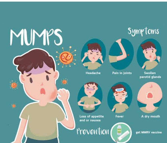 Symptoms of Mumps