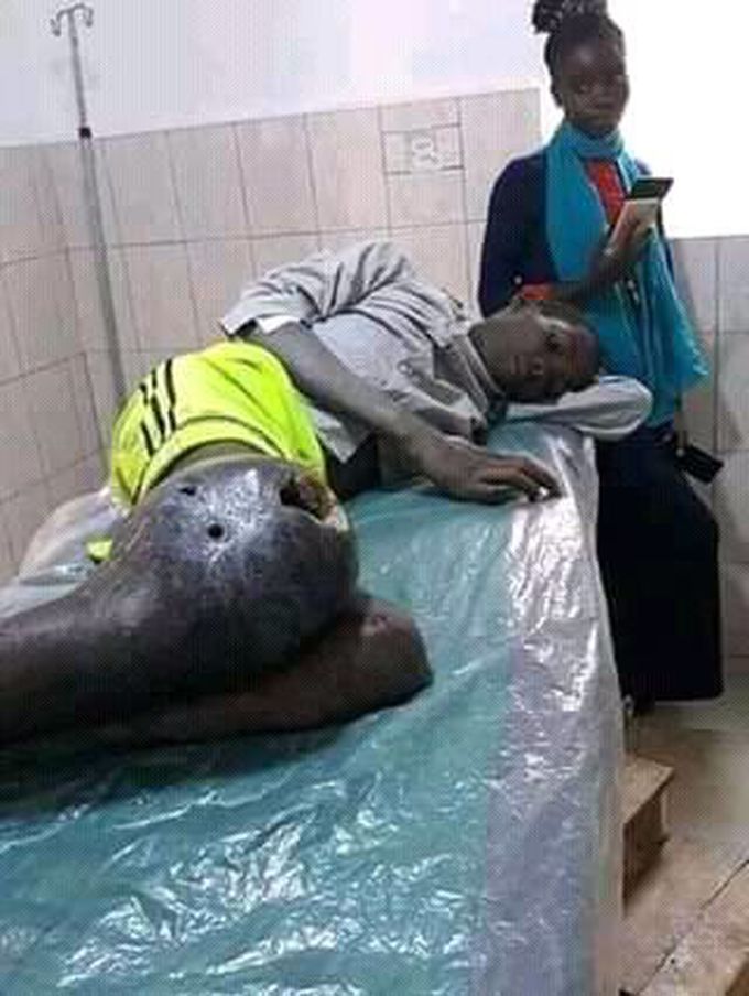 Is it's gangrene?????