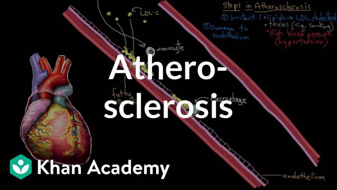 Atherosclerosis | Circulatory System and Disease | NCLEX-RN