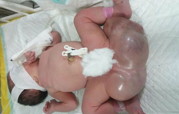 Whts the diagnosis of this poor baby ?? 😢😢