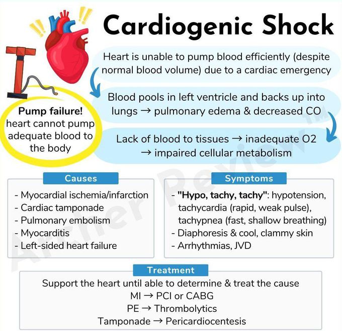 Cardiogenic Shock