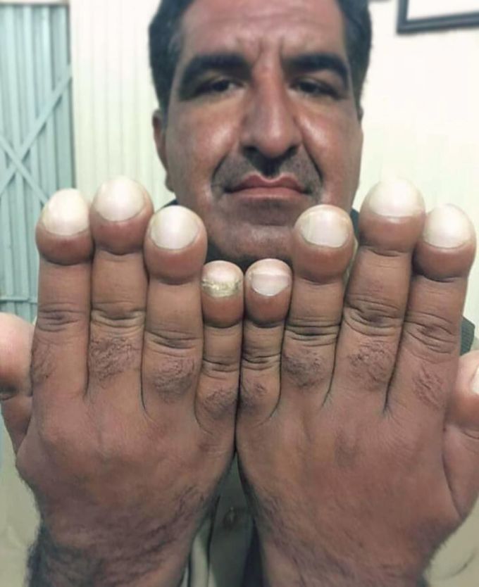 Medical case!!!