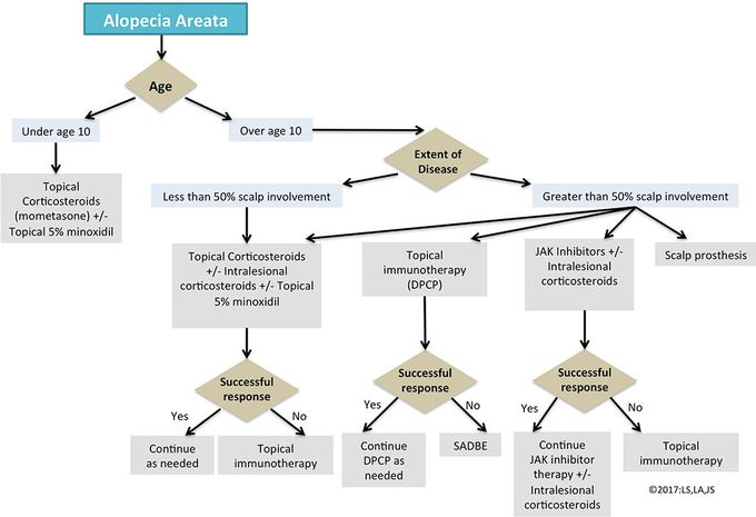 Alopecia Areata treatment