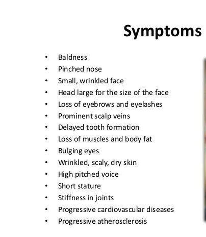 These are the symptoms of Hutchinson syndrome