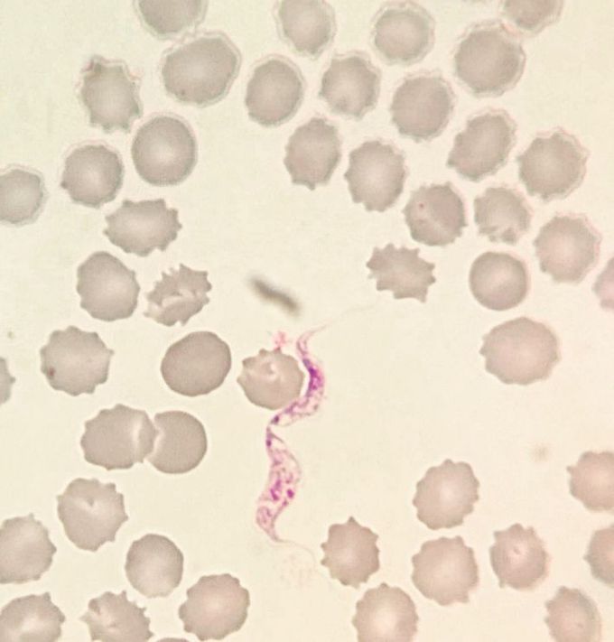 The kiss of Trypanosoma cruzi