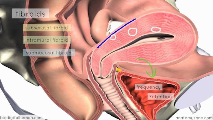 Clinical Reproductive Anatomy - Uterus - 3D Anatomy Tutorial