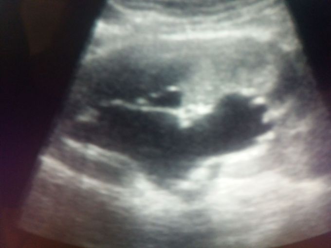 What are you see?????