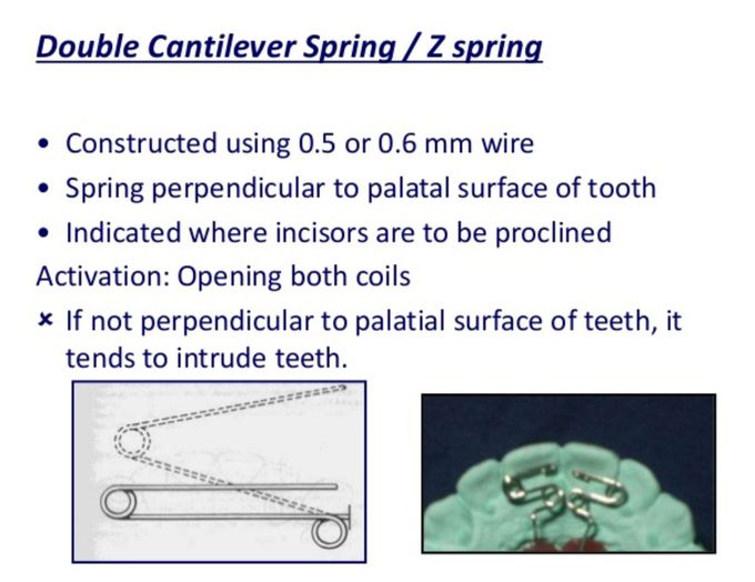 Z Spring