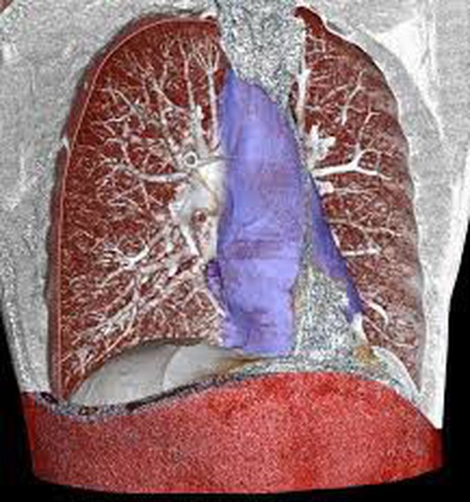 Causes of mediastinitis