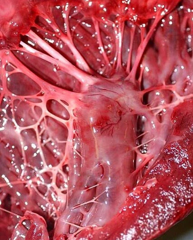 Papillary muscles &amp; chordae tendinae !!!
