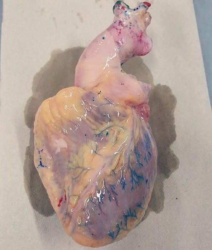 What's your diagnosis?