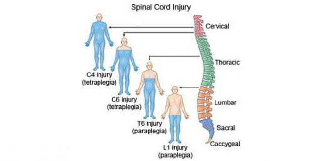 Spinal injury