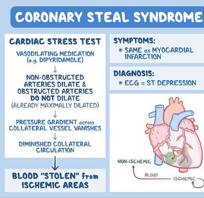 Coronary Steal Syndrome