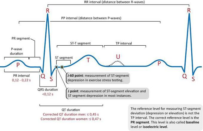 ECG interpretation