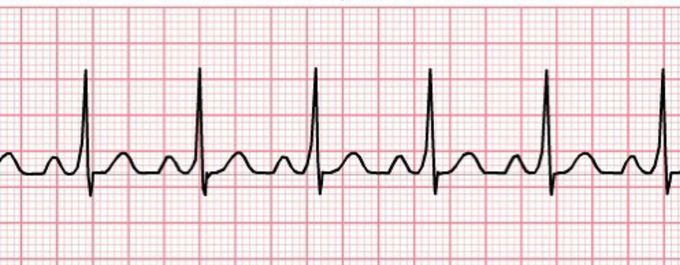 Dx and treatment??