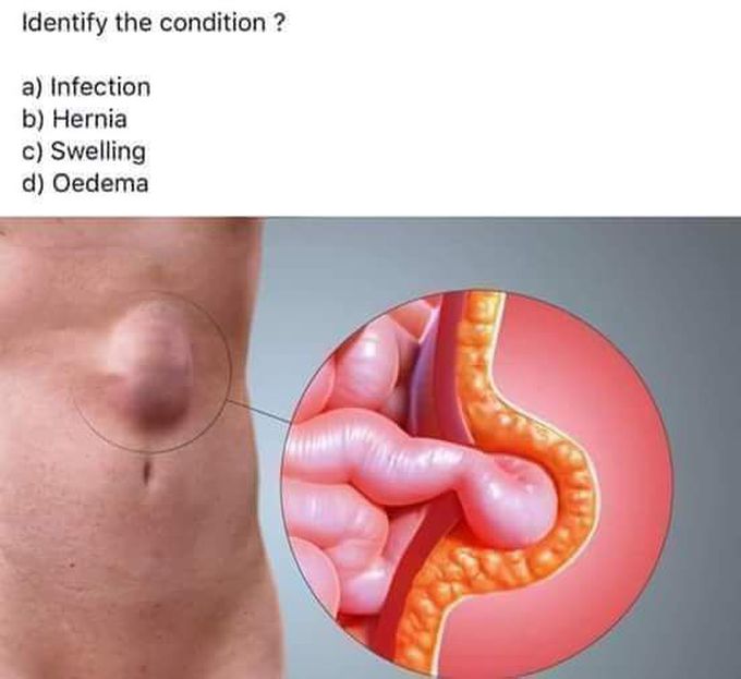Identify The Condition.....