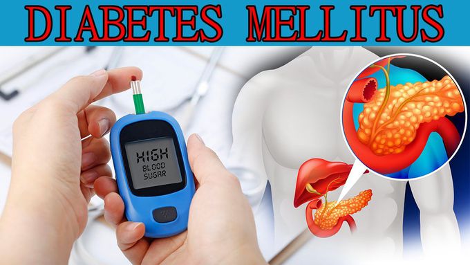 What is Diabetes Mellitus | Type 1, Type 2 | Diabetic Ketoacidosis | Sign & Symptoms