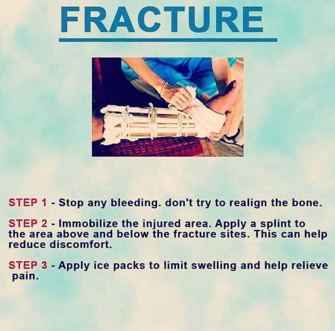 What to do during emergency