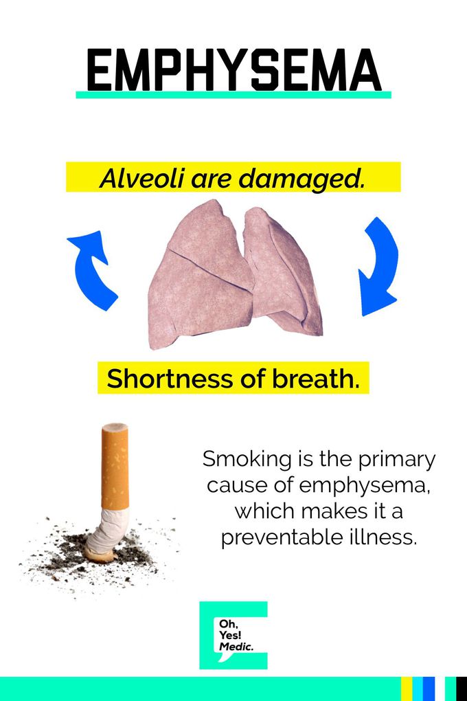 do-you-know-what-s-the-difference-between-emphysema-and-lung-medizzy