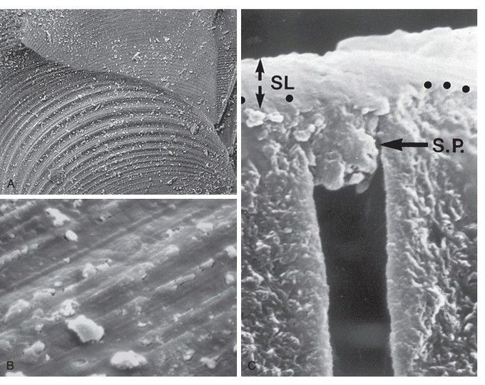 Smear layer formation