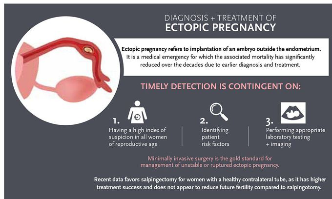 Treatment of ectopic pregnancy