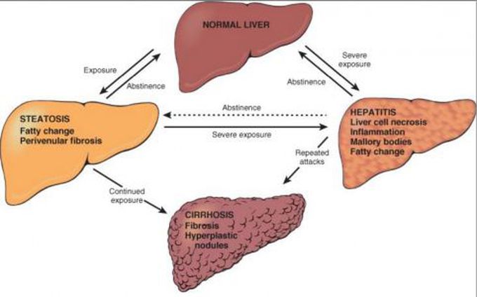 Liver case
