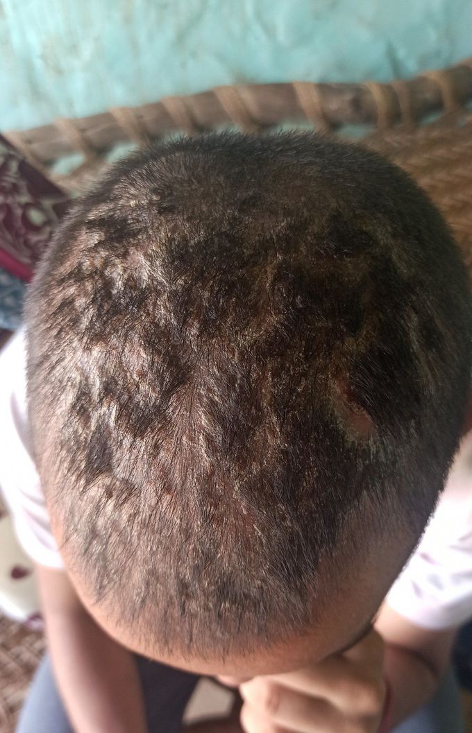 What is your diagnosis????