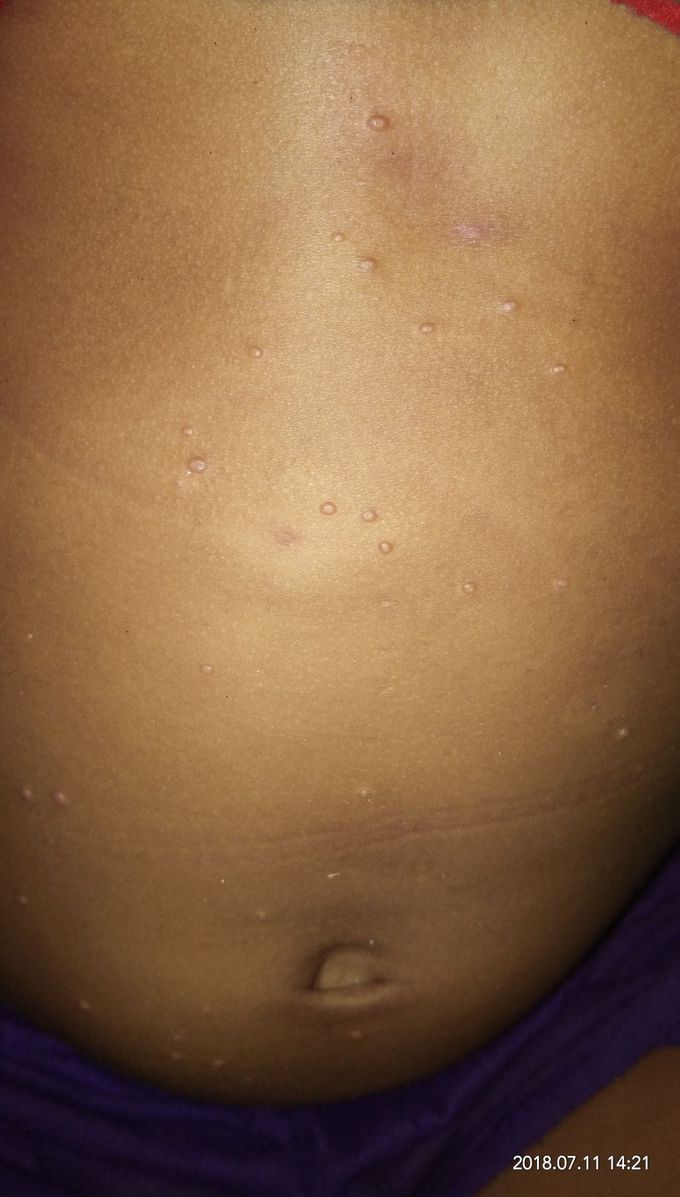 whats a diagnosis ??